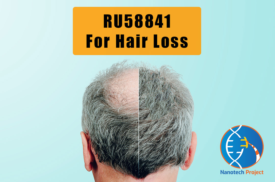 RU58841 for hair loss