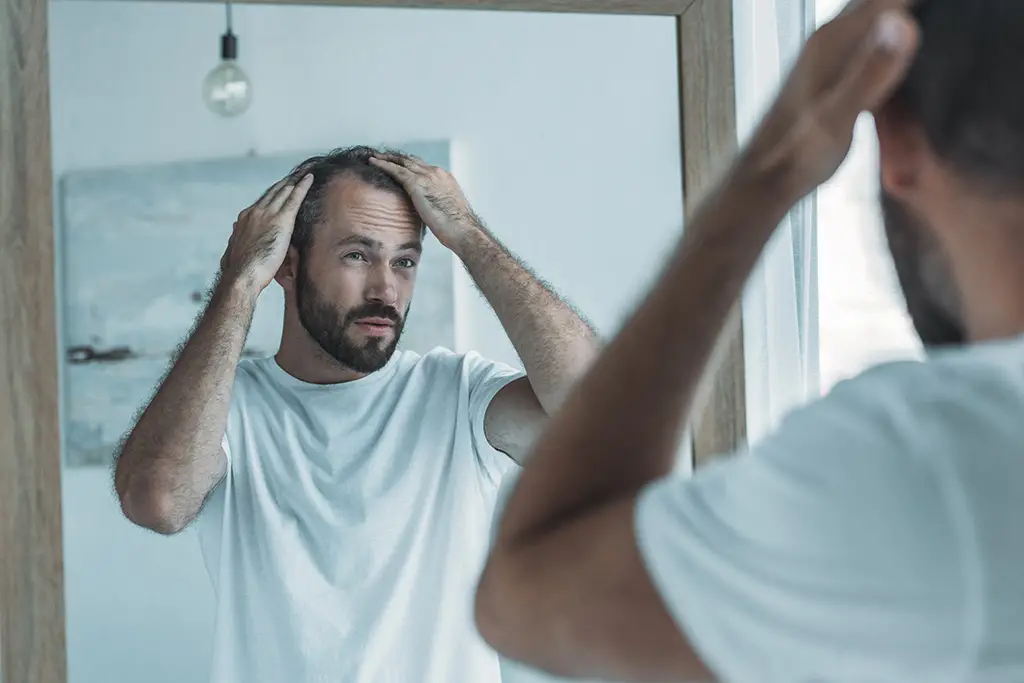man losing hair looking in mirror