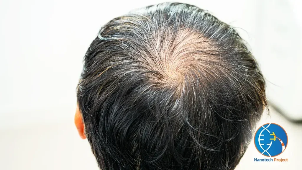 Do SARMs Cause Hair Fall | Feature Image